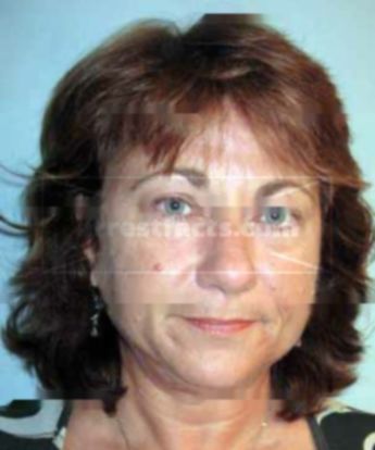 Theresa Lombardi