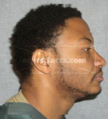 Tyrone B Robertson