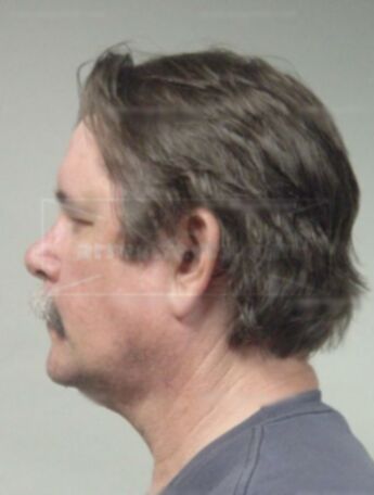 Eric A Helgeson