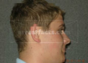 Dustin J Childs