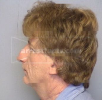 Darrin Lee Rose