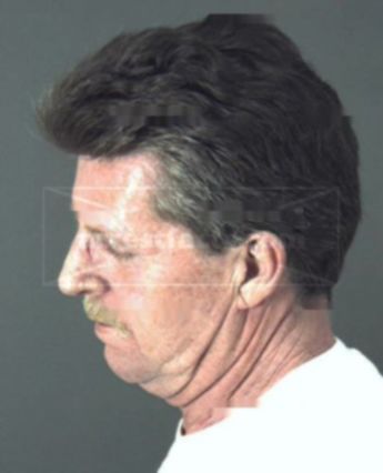 Larry Michael Shoopman