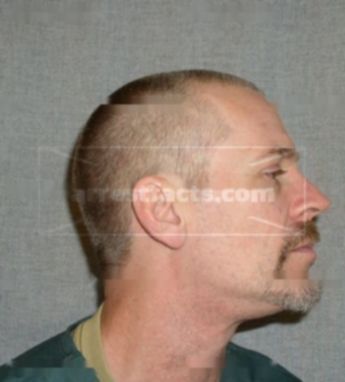 Scott B Comeaux