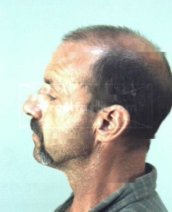 Terrence Roy Calkins