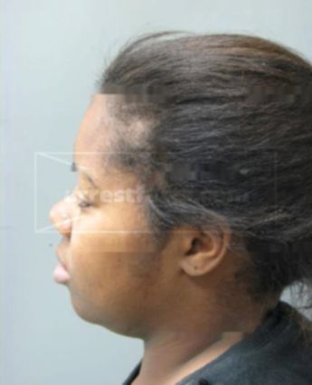 Mikeisha Mitchell