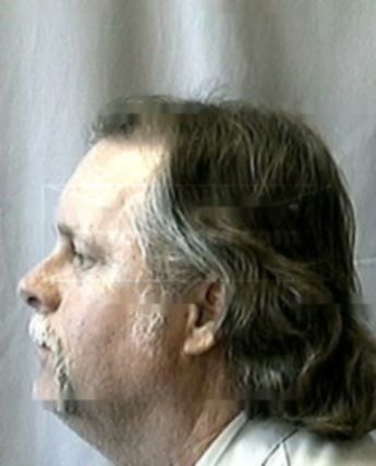 Michael K Huggan