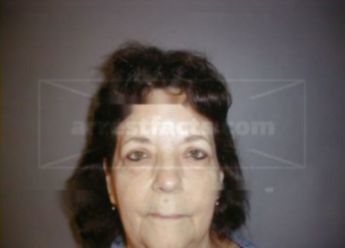 Lynn Anne Martel