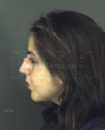 Leslie Renee Stoer