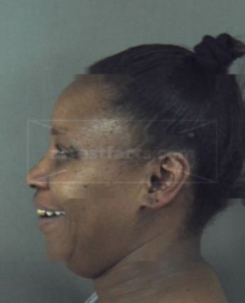 Annette Yvonne Dixon