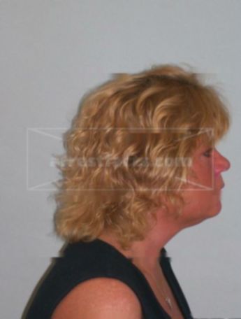 Sandra L Ehrfeld