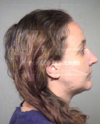 Allison D Bowditch