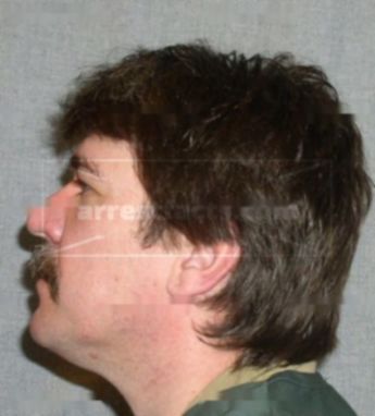 Patrick J Steiner