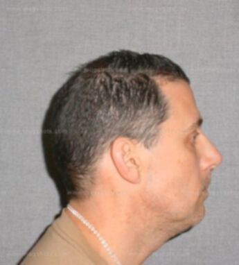 Raymond M Sabbatini