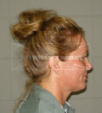Kristi Schounard