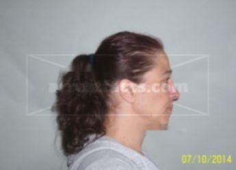 Lori E Kauzrich