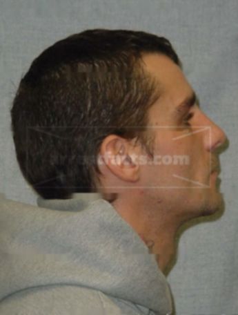 Chad Terzinski