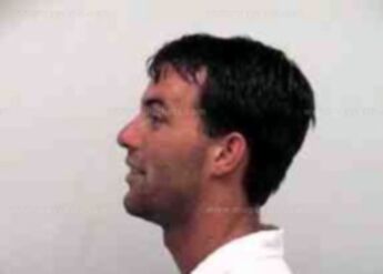 Timothy Brinson Siebold