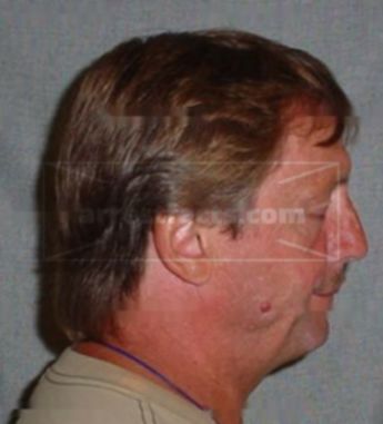 Ronald A Ottinger