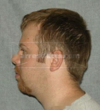 Justin J Keithley