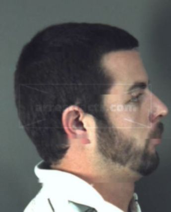 Aarron Christopher Damron