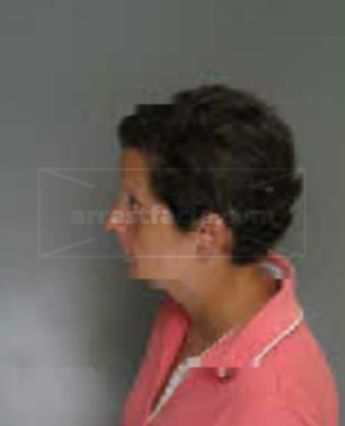 Rita Marie Blosser