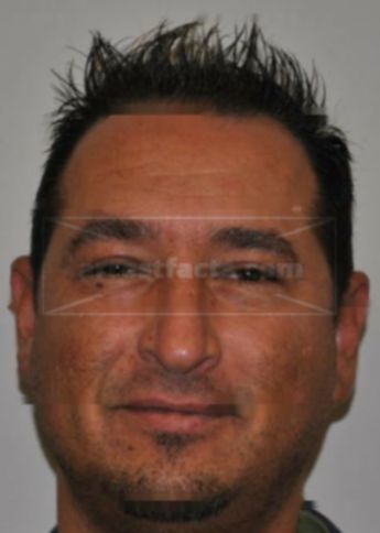 Leo J Liapis