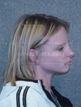 Carrie Jo Tottingham