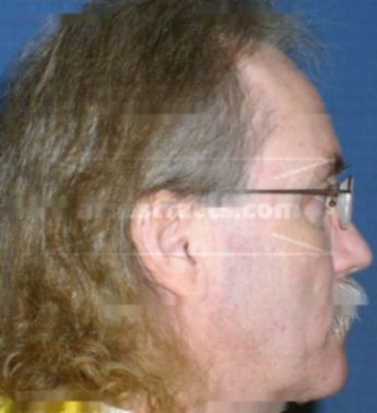 Ray C Burby