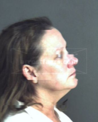 Susan Elliot
