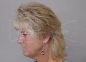 Linda L Gordon