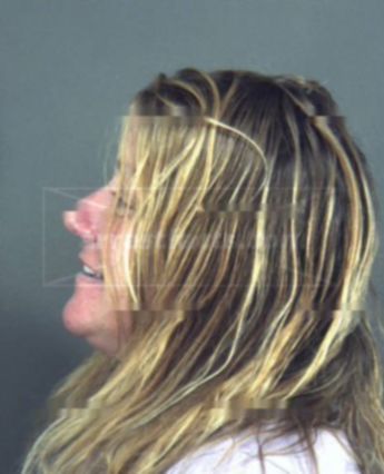 Carol A Dorner