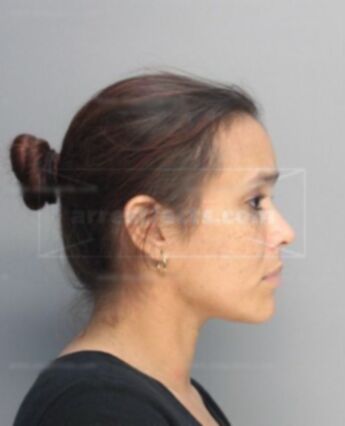 Yanet Portales