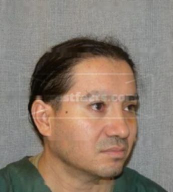 Ignacio L Lerma