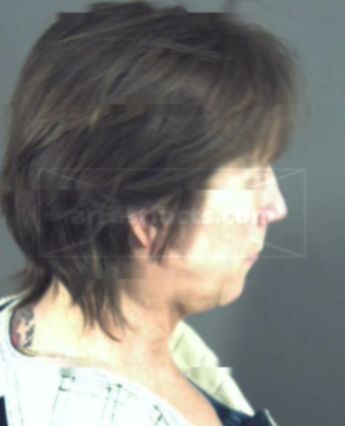 Susan Renee Rudolph