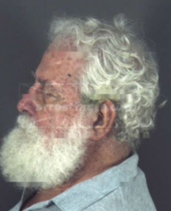 Bernard F Welch