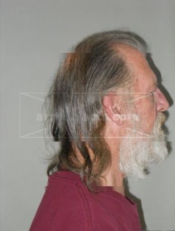 Larry R Stubbendick