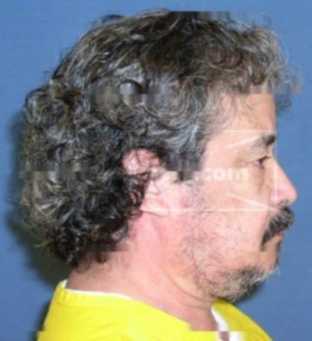Carlos Zelaya