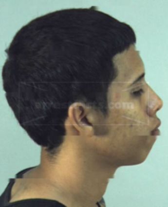 Jorge Luis Benito
