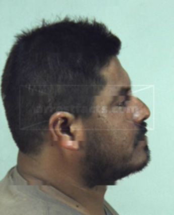 Oscar Hernandez