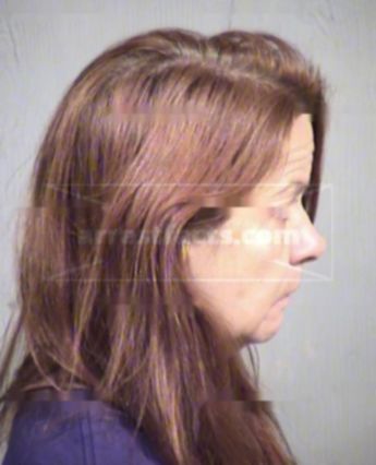 Roberta Weese Decrease