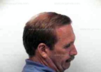 William Anthony Burns