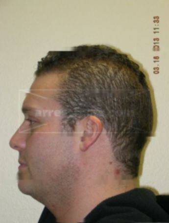 Travis B Jorgensen
