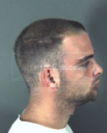Raymond Lee Berling Jr