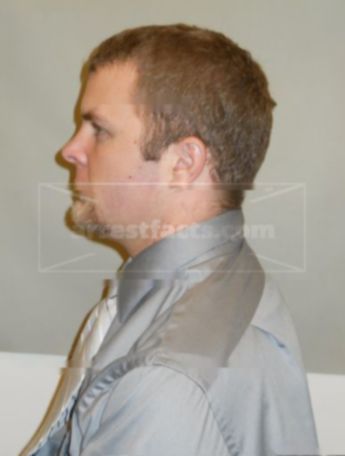 Chad A Hermanson