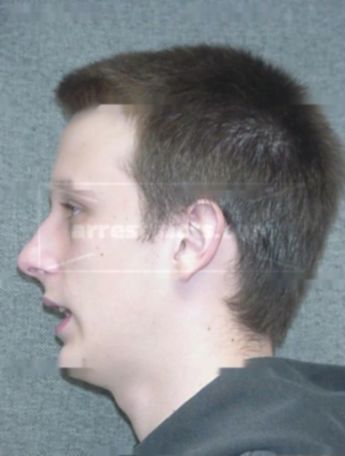 Dustin L Kinderman