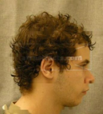 Michael A Erdman