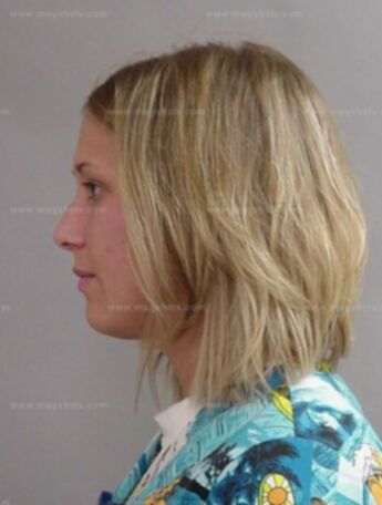 Renae J Popp