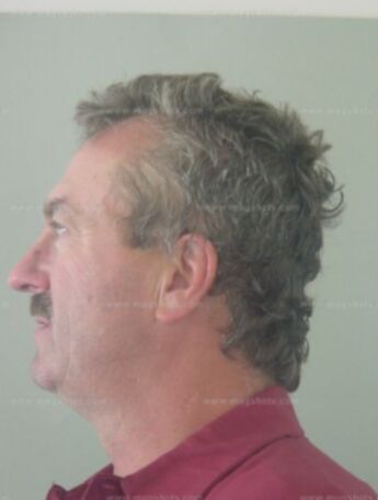 Michael J Gapp