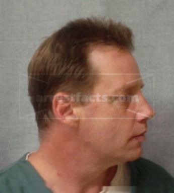 Steven T Hutchison