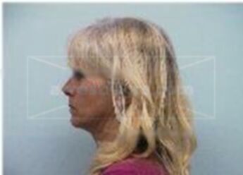 Linda Dahl Armstrong